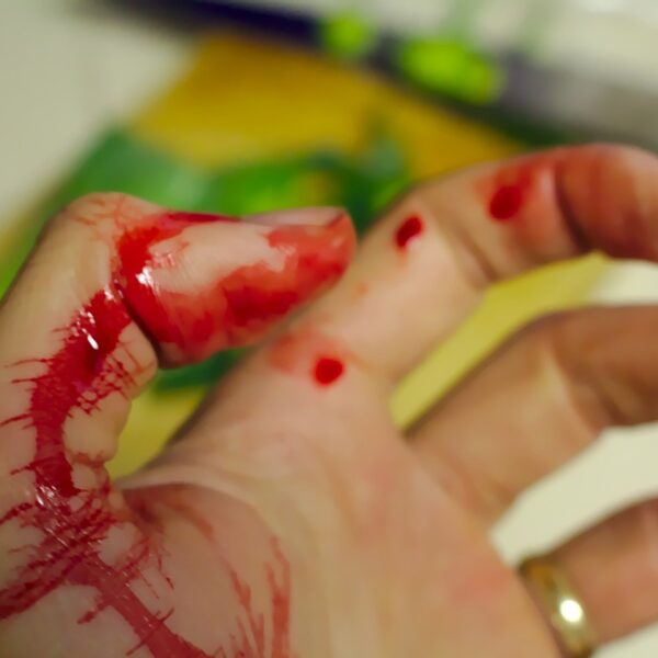 accident, bleed, bleeding